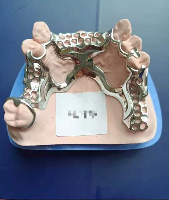 切削支架(纯钛)可摘局部义齿